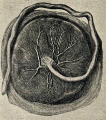 Placenta Photo